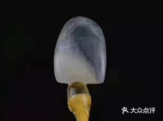 疑问：为什么我缺了一颗牙，医生却让镶我三颗？