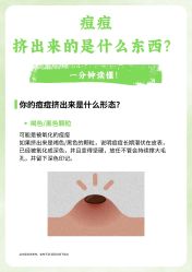 -苗方清颜·祛痘皮肤管理