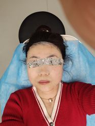 体验后-西安伊美尔医疗美容医院