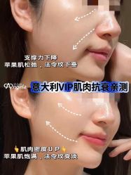 -安吉拉青春化管理中心