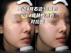 -上海伊莱美医疗美容医院