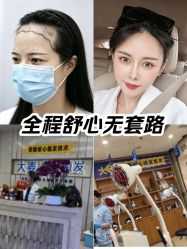 -大麦微针植发全国连锁