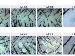 -丝客富脱发养发头皮馆