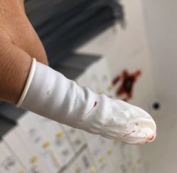 -荟草堂专业祛痘修护中心