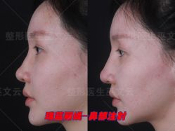 -北京米扬丽格医疗美容·联合丽格鼻整形中心