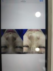 点击看大图 -蕾特恩专业祛痘·皮肤管理