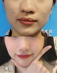 体验前-南京康美美容医院·旗舰店