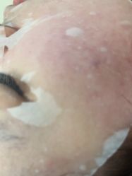 -柯莲娜医学美容