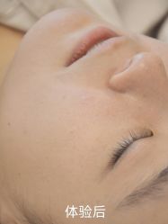 -清疣美疣·痣·斑净肤中心