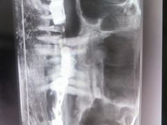 -土豆口腔(凤凰北总店)