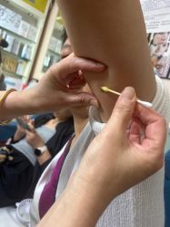 -北京美痣堂古方祛痣斑疣瘊