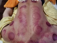 -脊艾堂推拿·艾灸(美年广场店)