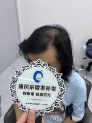 -唐风采假发补发定制