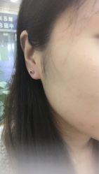 -Wisezone唯点穿耳打耳洞专业国际连锁品牌