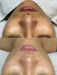 -美愈美肤MEIYU SKIN