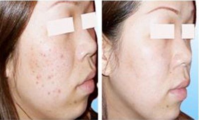 -SKINIST丽铂医疗美容