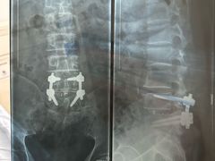 -哈尔滨医科大学附属第一医院(南岗院区)