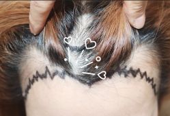 -大麦微针植发全国连锁