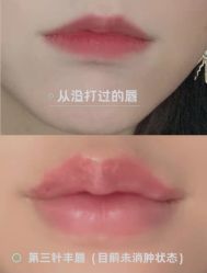 -上海漾颜医疗美容