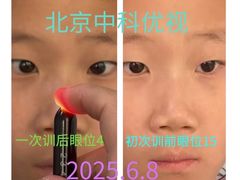 -中科优视医学研究院·验光配镜·近视防控