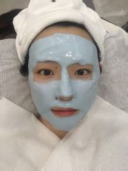 体验后-悟空祛痘·诺奖技术专业店