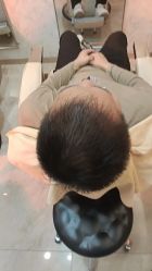-大麦微针植发丨全国连锁