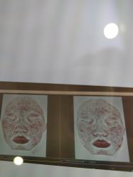 -苑苑vbeauty科技美容SPA