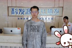 -大麦微针植发丨全国连锁