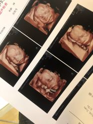 -杭州贝瑞斯美华妇儿医院·早孕·产检·儿科