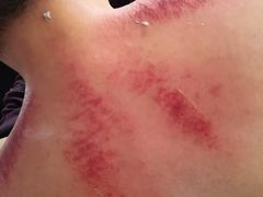 -沈师傅盲人按摩工作室(密三小区店)
