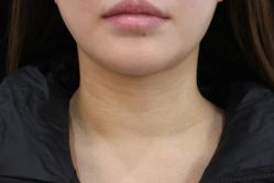 -丰联丽格医疗美容·联合丽格眼整形中心