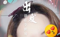 -大麦微针植发全国连锁