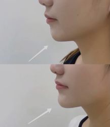 -上海漾颜医疗美容