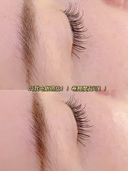 -宥莉·ULLY 痘敏肌•科技皮肤管理中心