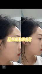 -雍禾植发全国连锁