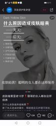 点击看大图 -凡碧诗毛孔清洁收细