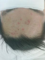 -痘博士北京·全国连锁祛痘机构