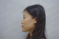 体验前-上海首尔丽格医疗美容医院