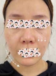 点击看大图 -Yestar 嘉兴艺星医疗美容医院