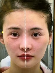 -Yestar杭州艺星医疗美容医院
