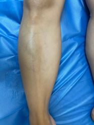 点击看大图 -深圳美莱医疗美容医院