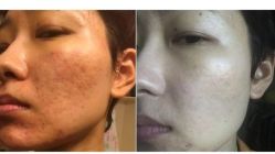 -SKINIST丽铂医疗美容