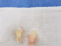 -Dr.Z dental仁康种植矫正中心