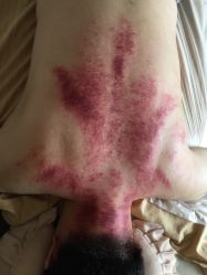 -悦艾堂·中医拔罐减肥·美体艾灸连锁