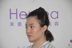 点击看大图 -禾美嘉医疗美容