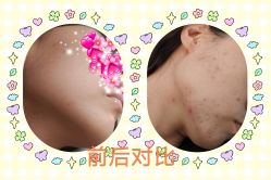 -坤如玛丽·医疗美容中心