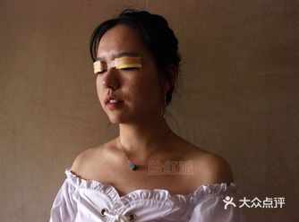 做完双眼皮手术了，医生说明天才可以拆纱布，期待效果