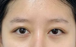 -张小野·专业半永久纹眉