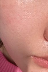 体验后-南京医科大学友谊整形外科医院