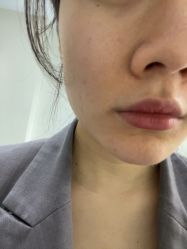 -长沙雅美医疗美容医院